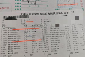 黑龙江新增29例确诊-黑龙江新增本土确诊病例26例