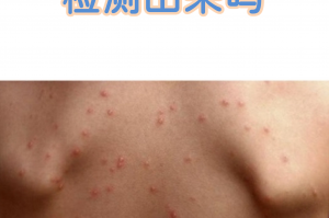 1确诊曾17次核酸阴性〃17次核酸检测阳性