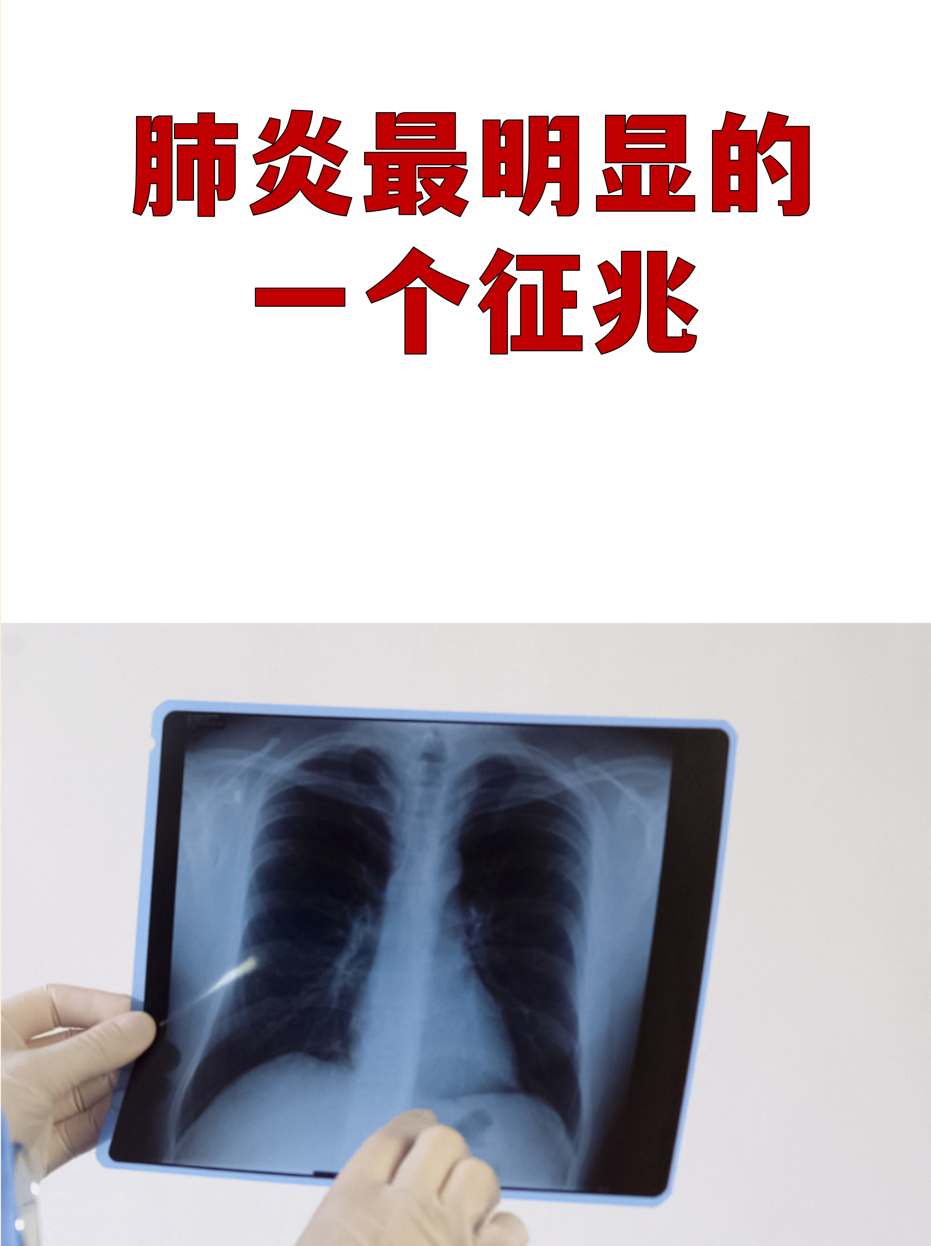 31省区市新增78例无症状感染者-31省区市新增无症状感染37例-第1张图片
