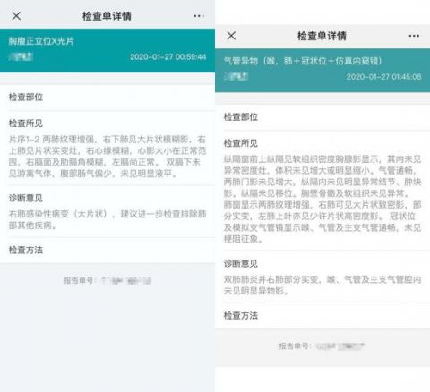 全国肺炎最新消息人数,全国肺炎最新消息人数更新-第1张图片