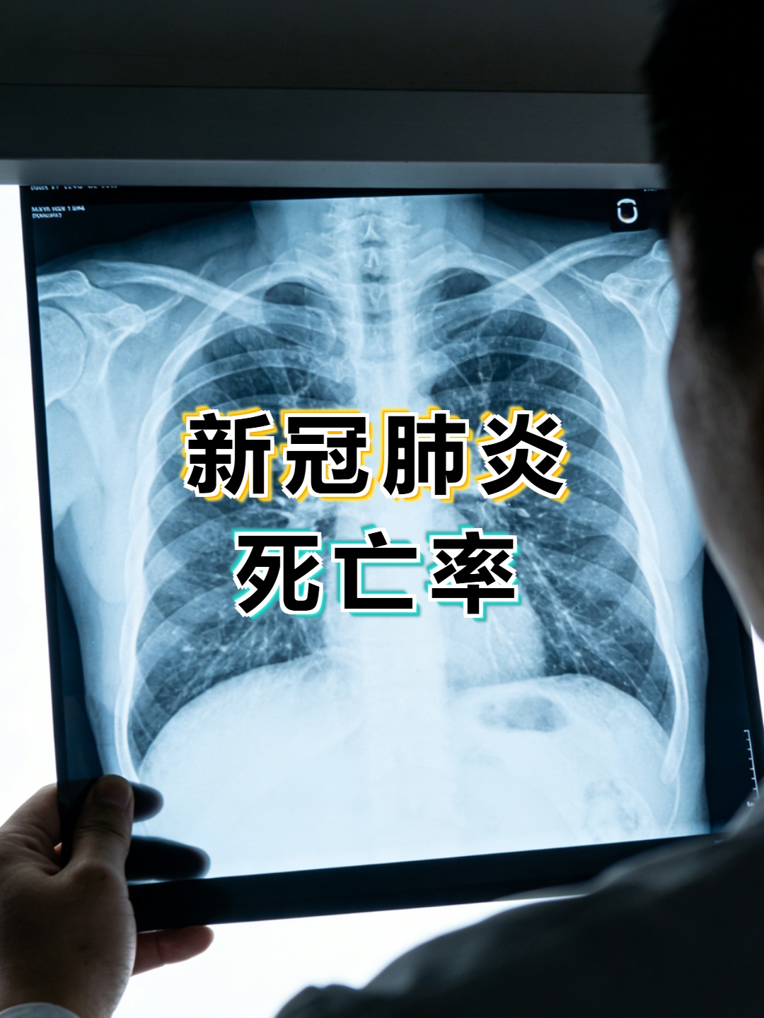 新冠中国预计死亡人口-新冠中国死亡率多少-第1张图片