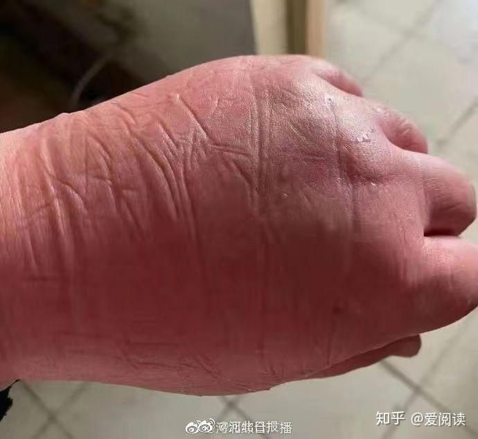 河北新增77例无症状.河北新增69例无症状问责-第1张图片